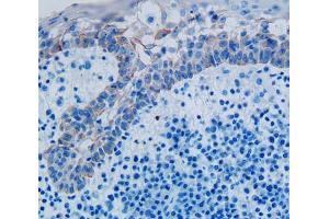 Used in DAB staining on fromalin fixed paraffin- embedded skin cancer tissue