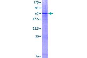 Image no. 1 for Protease, Serine, 21 (Testisin) (PRSS21) (AA 1-314) protein (GST tag) (ABIN1316473)