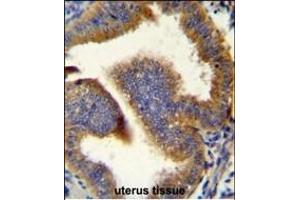 CCNB1 Antibody (C-term) (ABIN655054 and ABIN2844683) immunohistochemistry analysis in formalin fixed and paraffin embedded human uterus tissue followed by peroxidase conjugation of the secondary antibody and DAB staining.