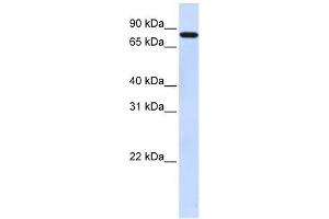 WB Suggested Anti-ZNF287 Antibody Titration:  0. (ZNF287 anticorps  (N-Term))