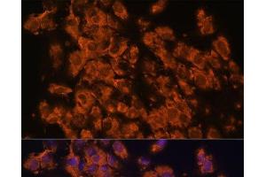Immunofluorescence analysis of C6 cells using LRRC7 Polyclonal Antibody at dilution of 1:100. (LRRC7 anticorps)