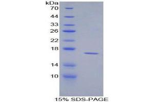SDS-PAGE (SDS) image for CD59 (CD59) (AA 22-96) protein (His tag) (ABIN1080584) (CD59 Protein (CD59) (AA 22-96) (His tag))