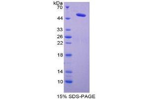 SDS-PAGE (SDS) image for Lysyl Oxidase (LOX) (AA 213-417) protein (His tag,GST tag) (ABIN1878181) (LOX Protein (AA 213-417) (His tag,GST tag))