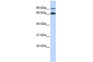 FZD10 antibody used at 1 ug/ml to detect target protein. (FZD10 anticorps)