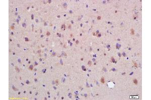 Formalin-fixed and paraffin embedded rat brain labeled with Rabbit Anti SYTL5/slp5 Polyclonal Antibody, Unconjugated (ABIN754498) at 1:200 followed by conjugation to the secondary antibody and DAB staining (SYTL5 anticorps  (AA 801-921))
