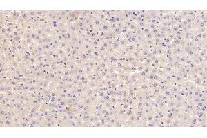 Detection of APOE in Rat Liver Tissue using Polyclonal Antibody to Apolipoprotein E (APOE)