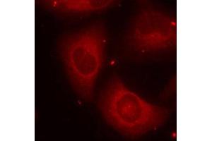Immunofluorescence staining of methanol-fixed Hela cells using Phospho-LIMK2-T505 antibody. (LIMK2 anticorps  (pThr505))