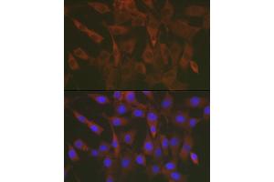 Immunofluorescence analysis of NIH/3T3 cells using ERK1 / ERK2 Rabbit pAb (ABIN7268619) at dilution of 1:50 (40x lens).
