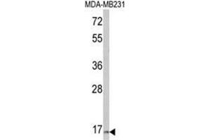 Western blot analysis of TSHB Antibody (Center) in MDA-MB231 cell line lysates (35ug/lane). (TSHB anticorps  (Middle Region))