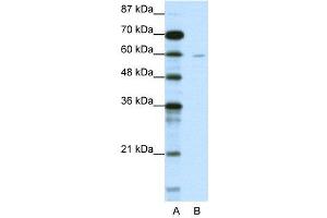 WB Suggested Anti-DCP1A  Antibody Titration: 1.