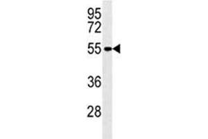 MMP14 antibody western blot analysis in A2058 lysate (MMP14 anticorps  (AA 470-499))