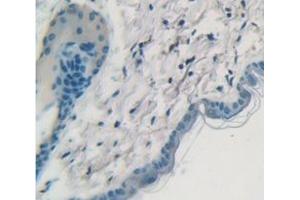 IHC-P analysis of Mouse Tissue, with DAB staining. (Cytokeratin 1 anticorps  (AA 189-497))