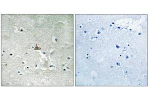 Immunohistochemistry analysis of paraffin-embedded human brain tissue using Trk B (Phospho-Tyr706+Tyr707) antibody. (TRKB anticorps  (pTyr706, pTyr707))