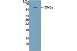 Detection of Recombinant COQ6, Human using Polyclonal Antibody to Coenzyme Q6 Homolog, Monooxygenase (COQ6) (COQ6 anticorps  (AA 1-468))