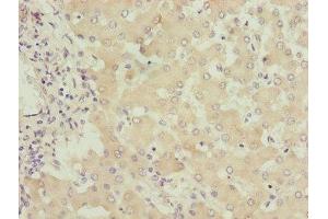 Immunohistochemistry of paraffin-embedded human liver tissue using ABIN7149960 at dilution of 1:100 (FMO4 anticorps  (AA 1-300))