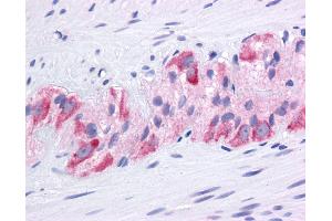 Immunohistochemistry (IHC) image for anti-Heat Shock Protein 90kDa alpha (Cytosolic), Class A Member 1 (HSP90AA1) (N-Term) antibody (ABIN2779296)