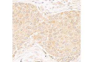 Immunohistochemistry (IHC) image for anti-DEAD (Asp-Glu-Ala-As) Box Polypeptide 19B (DDX19B) (C-Term) antibody (ABIN7453856) (DDX19B anticorps  (C-Term))