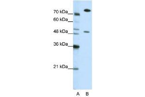 SSB antibody used at 0. (SSB anticorps)