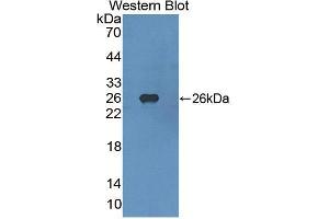 Western blot analysis of the recombinant protein. (FGFR4 anticorps  (AA 165-366))
