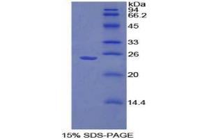 SDS-PAGE analysis of Mouse Sprouty Homolog 1 Protein. (SPRY1 Protéine)