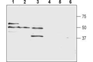 Western blot analysis of human  acute monocytic leukemia cell lysates (lanes 1 and 4), human Jurkat T cell leukemia cell lysates (lanes 2 and 5) and human  colorectal adenocarcinoma cell lysates (lanes 3 and 6):1-3.