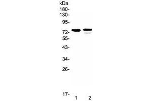 Western blot testing of human 1) SK-OV-3 and 2) Jurkat lystate with FZD3 antibody at 0. (FZD3 anticorps)