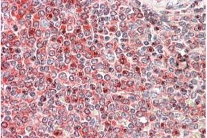 ABIN1590084 (5µg/ml) staining of paraffin embedded Human Spleen. (PKC beta anticorps  (Internal Region))