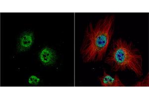 ICC/IF Image ZWINT antibody detects ZWINT protein at nucleus by immunofluorescent analysis. (ZWINT anticorps  (Center))