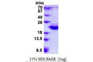 Figure annotation denotes ug of protein loaded and % gel used. (BCL2L10 Protéine)