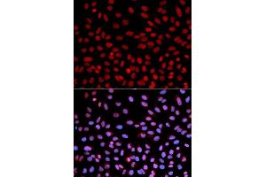 Immunofluorescence analysis of U2OS cells using POLH antibody. (POLH anticorps  (AA 20-320))