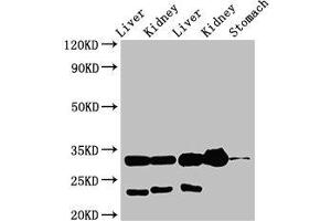 Western Blot Positive WB detected in: Rat liver tissue, Rat kidney tissue, Mouse liver tissue, Mouse kidney tissue, Mouse stomach tissue All lanes: TPSB2 antibody at 3 μg/mL Secondary Goat polyclonal to rabbit IgG at 1/50000 dilution Predicted band size: 31 kDa Observed band size: 31 kDa (TPSB2 anticorps  (AA 31-275))