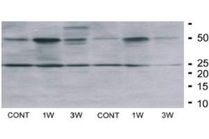 Fat Homogenates Stained by Irisin Antibody (FNDC5 anticorps  (AA 42-112) (Magnetic Particles))