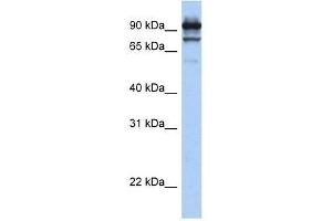 Western Blot showing STAT6 antibody used at a concentration of 1.