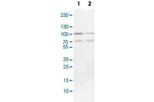 Western Blot analysis of Lane 1: NIH-3T3 cell lysate (mouse embryonic fibroblast cells) and Lane 2: NBT-II cell lysate (Wistar rat bladder tumor cells) with FOXP1 polyclonal antibody .