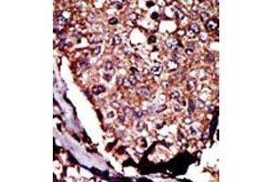 Image no. 2 for anti-Diacylglycerol Kinase, beta 90kDa (DGKB) (C-Term) antibody (ABIN360610) (DGKB anticorps  (C-Term))