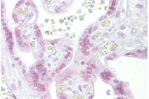 Anti-CHEK2 / CHK2 antibody IHC staining of human placenta. (CHEK2 anticorps  (N-Term))