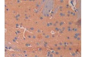 Used in DAB staining on fromalin fixed paraffin- embedded kidney tissue