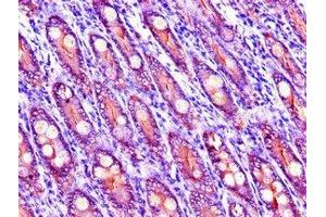 Immunohistochemistry of paraffin-embedded human small intestine tissue using ABIN7151743 at dilution of 1:100 (LIPG anticorps  (AA 360-500))