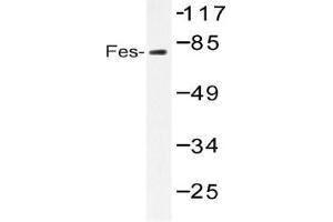 Western blot (WB) analysis of Fes antibody in extracts from HUVEC serum 20 (FES anticorps)