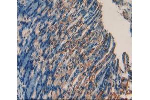Used in DAB staining on fromalin fixed paraffin- embedded stomach tissue (RANKL anticorps  (AA 92-263))