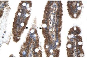 Human Intestine (PGRMC1 anticorps  (N-Term))