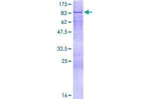 Image no. 1 for Fanconi Anemia, Complementation Group E (FANCE) (AA 1-536) protein (GST tag) (ABIN1353630)