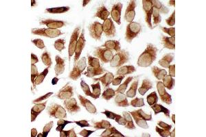 Anti-TRAM1 antibody, ICC ICC: HELA Cell