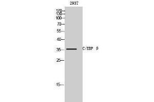 Western Blotting (WB) image for anti-CCAAT/enhancer Binding Protein (C/EBP), beta (CEBPB) (C-Term) antibody (ABIN3174088) (CEBPB anticorps  (C-Term))