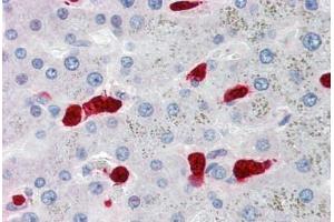 Human Liver, Hepatocytes and Macrophages (formalin-fixed, paraffin-embedded) stained with S100A8 antibody ABIN334264 at 5 ug/ml followed by biotinylated anti-mouse IgG secondary antibody ABIN481714, alkaline phosphatase-streptavidin and chromogen. (S100A8 anticorps)