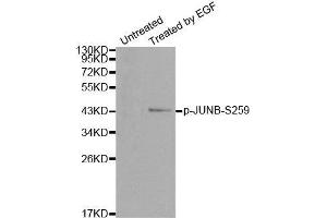 Western blot analysis of extracts from HT29 cells, using Phospho-JUNB-S259 antibody. (JunB anticorps  (pSer259))