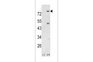 Western blot analysis of PIK3R5 using rabbit polyclonal PIK3R5 Antibody using 293 cell lysates (2 ug/lane) either nontransfected (Lane 1) or transiently transfected with the PIK3R5 gene (Lane 2).