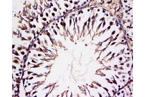 Paraformaldehyde-fixed, paraffin embedded Rat testis tissue Antigen retrieval by boiling in sodium citrate buffer(pH6) for 15 minutes Block endogenous peroxidase by 3% hydrogen peroxide for 30 minutes Blocking buffer (normal goat serum) at 37°C for 20 minutes Antibody incubation with HECT E3 Polyclonal Antibody, Unconjugated  at 1:200 overnight at 4°C, followed by a conjugated secondary antibody and DAB staining. (Hect E3 Ubiquitin Ligase anticorps  (AA 1-100))