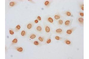 Immunocytochemistry analysis of ABIN7139155 diluted at 1:5 and staining in Hela cells (treated with 30mM sodium butyrate for 4h) performed on a Leica BondTM system.