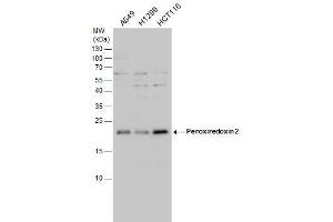 WB Image Peroxiredoxin 2 antibody detects Peroxiredoxin 2 protein by western blot analysis. (Peroxiredoxin 2 anticorps)